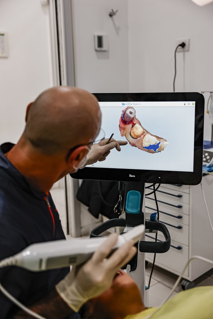 impiantologia a Milano